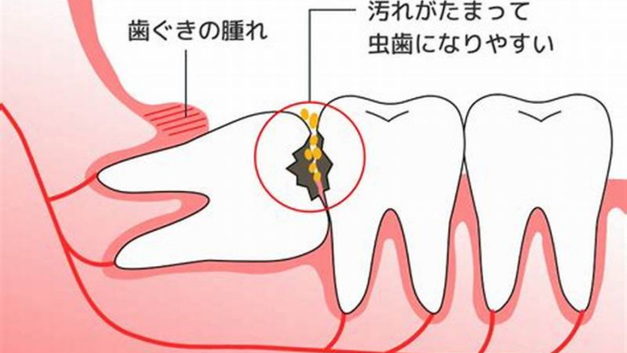 日语阅读 - 日语二级笔译阅读理解篇第4单元 体育、卫生 - MOJi辞書